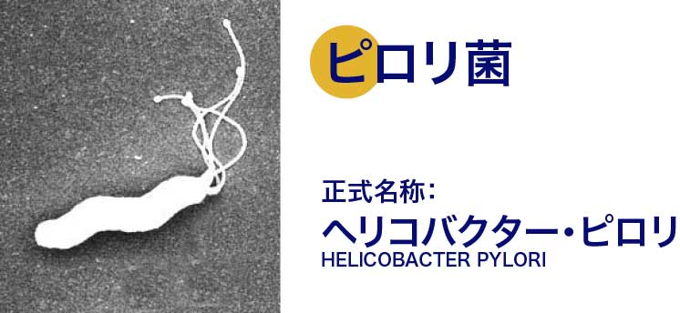 内視鏡検査器具洗浄装置